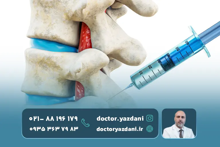 تزریق-درمانی-کمر 